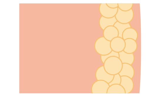 4:脂肪細胞の減少の図