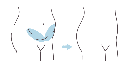 腹部：2箇所の施術の図