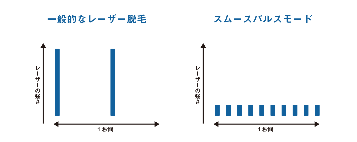 レーザー光の照射間隔