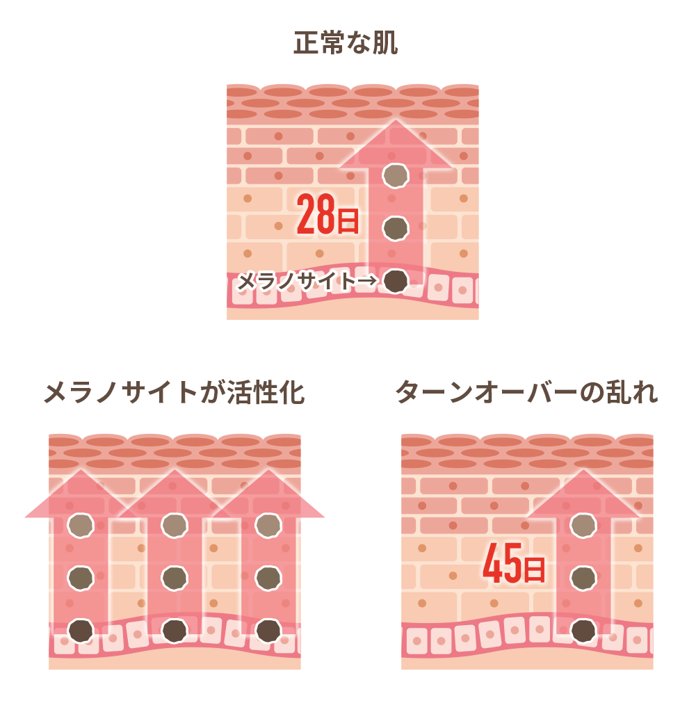 シミができるメカニズムの図解